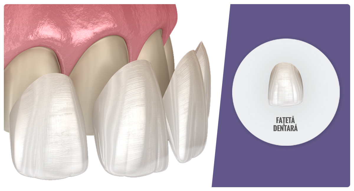 Fatete Dentare Medical Tours Company Fatete Dentare Medical Tours Company